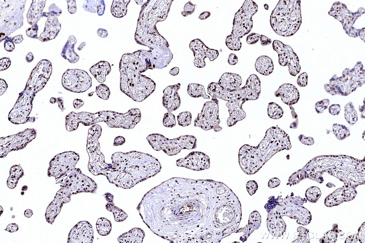 IHC staining of human placenta using 14708-1-AP IHC staining of human placenta using 14708-1-AP