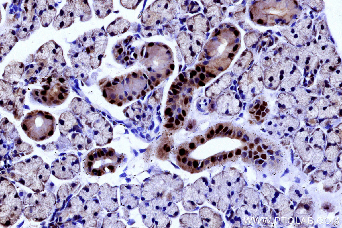 IHC staining of rat salivary gland using 14708-1-AP IHC staining of rat salivary gland using 14708-1-AP