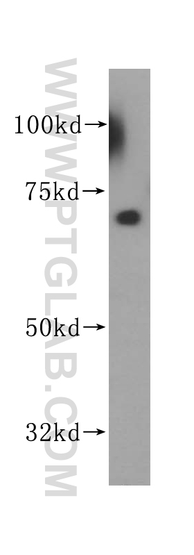 WB analysis of HepG2 using 14708-1-AP