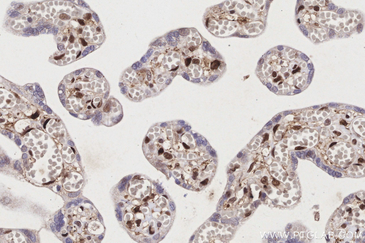 IHC staining of human placenta using 15978-1-AP IHC staining of human placenta using 15978-1-AP