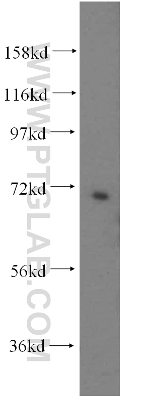 WB analysis of HepG2 using 15978-1-AP