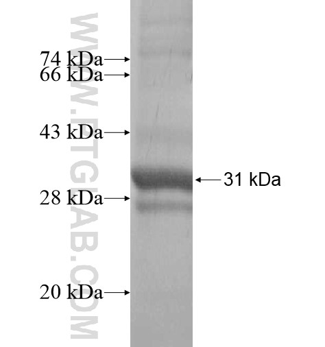 PAQR5 fusion protein Ag14067 SDS-PAGE PAQR5 fusion protein Ag14067 SDS-PAGE