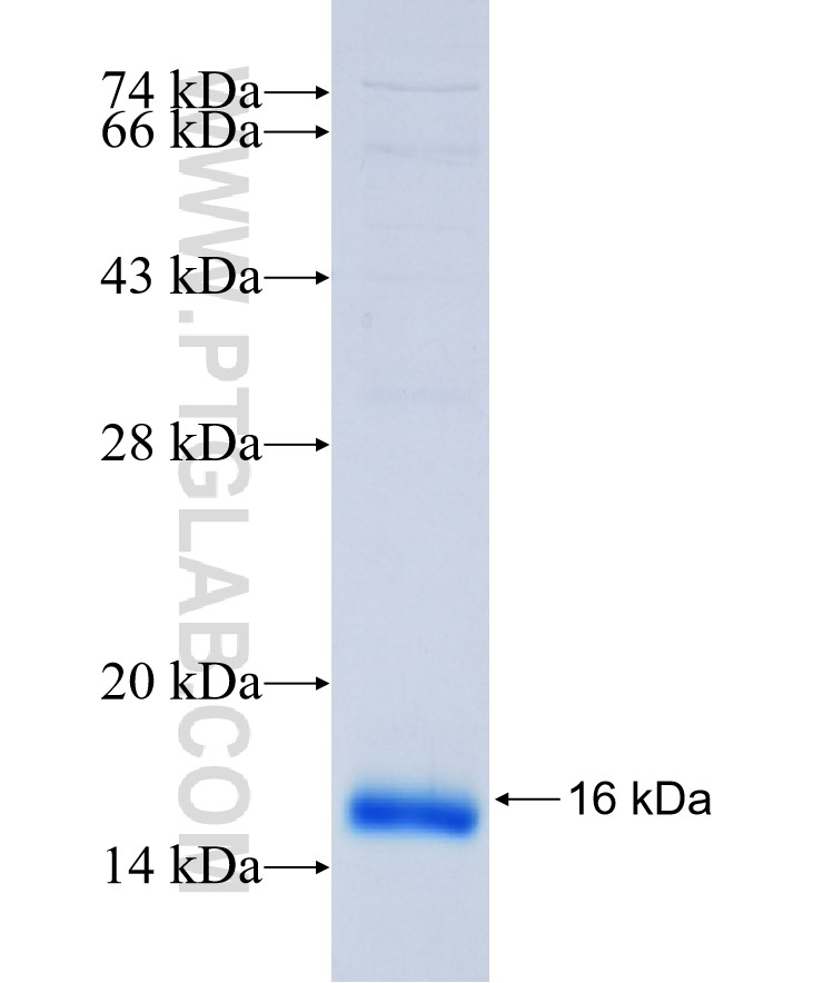 PAQR7 fusion protein Ag37141 SDS-PAGE PAQR7 fusion protein Ag37141 SDS-PAGE