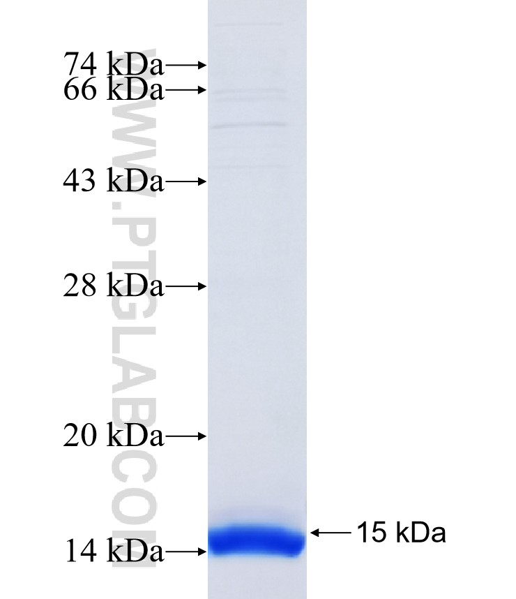PAQR8 fusion protein Ag14509 SDS-PAGE PAQR8 fusion protein Ag14509 SDS-PAGE