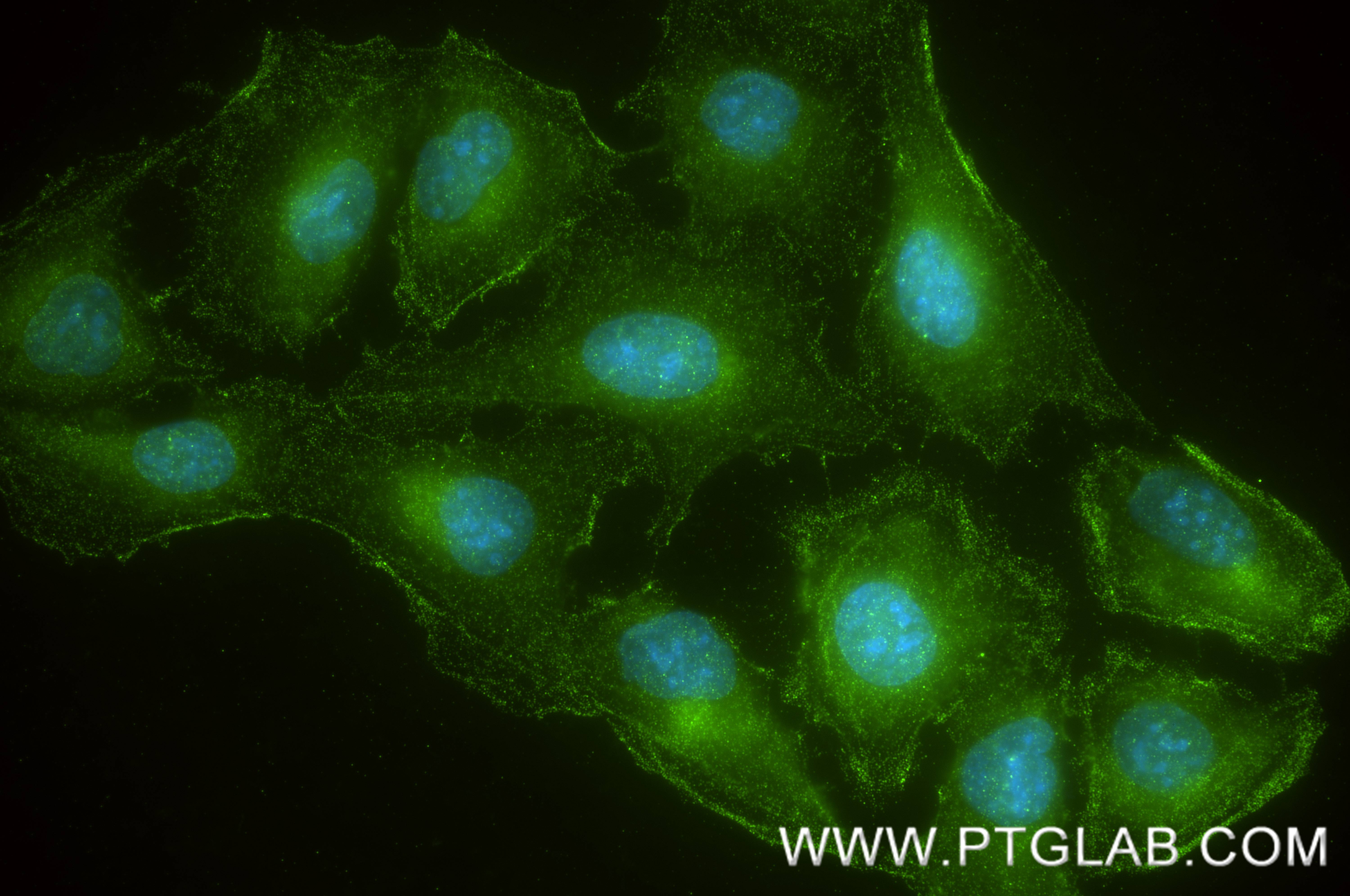 IF Staining of U2OS using 84593-1-RR IF Staining of U2OS using 84593-1-RR