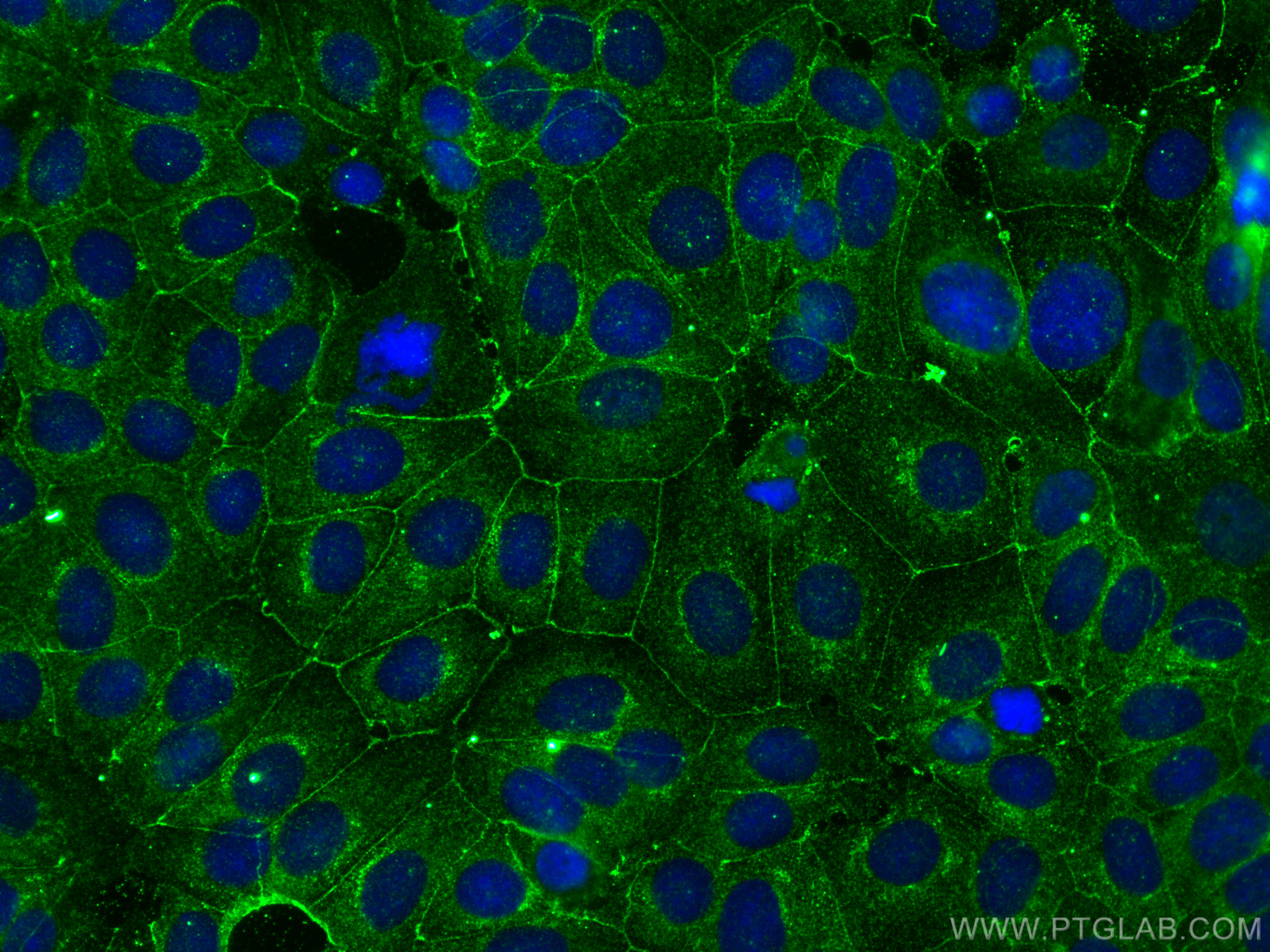 IF Staining of MCF-7 using 66968-1-Ig (same clone as 66968-1-PBS)