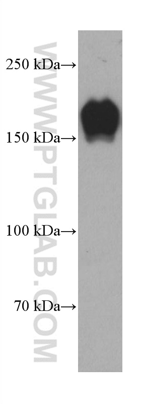 WB analysis of MCF-7 using 66968-1-Ig