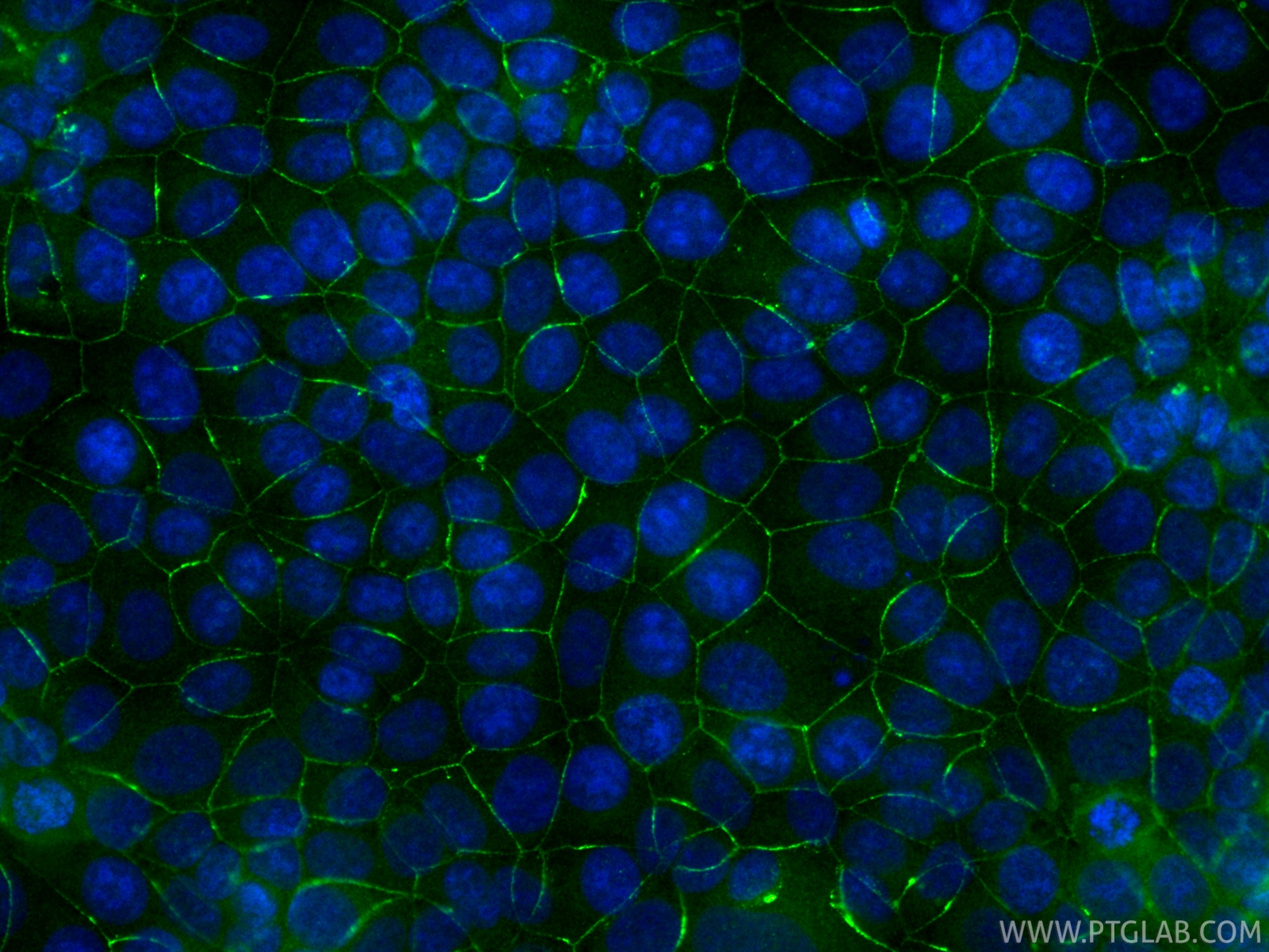 IF Staining of MCF-7 using CL488-11085