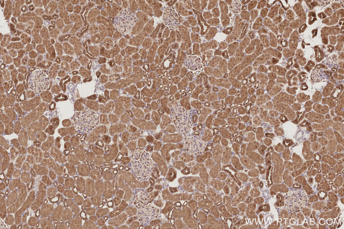 IHC staining of rat kidney using 13996-1-AP IHC staining of rat kidney using 13996-1-AP