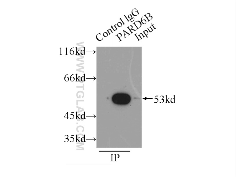 IP experiment of HEK-293 using 13996-1-AP