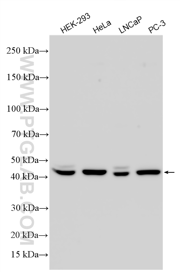 Various lysates were subjected to SDS PAGE followed by western blot with 13996-1-AP (PARD6B antibody) at dilution of 1:4000 incubated at room temperature for 1.5 hours. WB analysis using 13996-1-AP