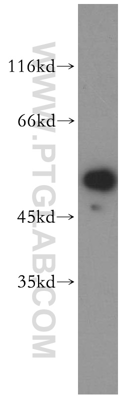 WB analysis of HeLa using 13996-1-AP