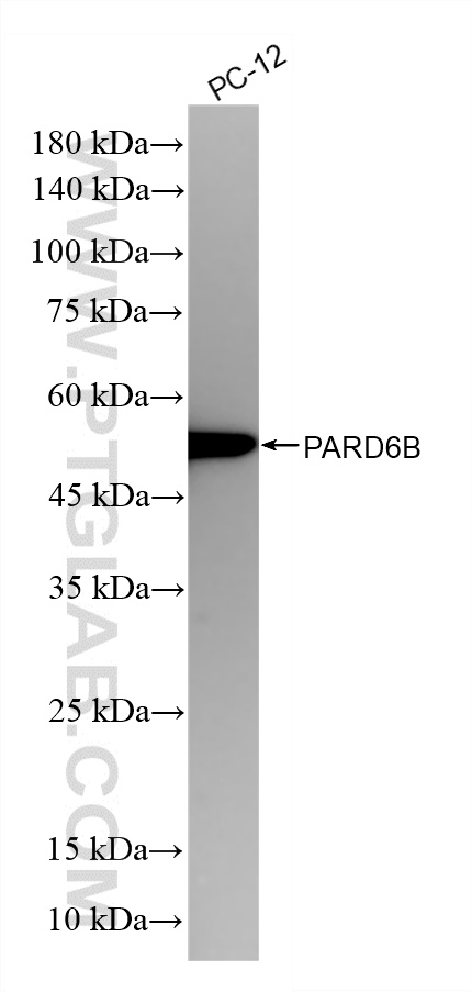 WB analysis using 86786-1-RR WB analysis using 86786-1-RR