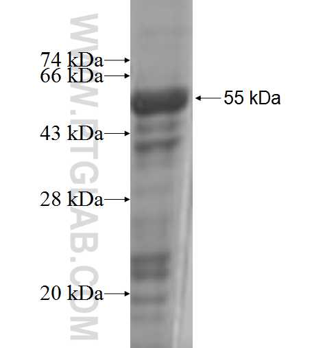 PARD6B fusion protein Ag6025 SDS-PAGE PARD6B fusion protein Ag6025 SDS-PAGE