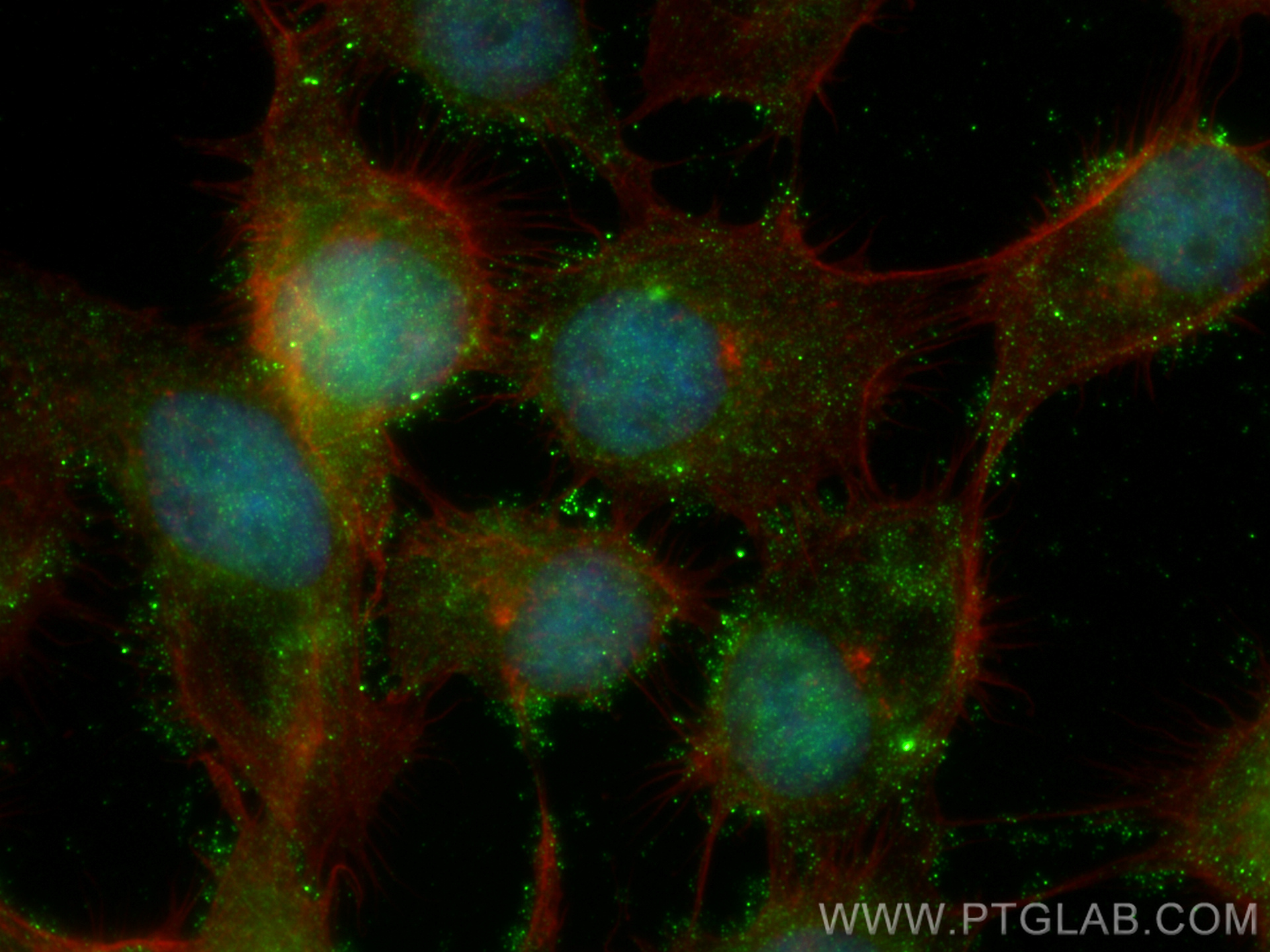 IF Staining of A431 using 67946-1-Ig (same clone as 67946-1-PBS)