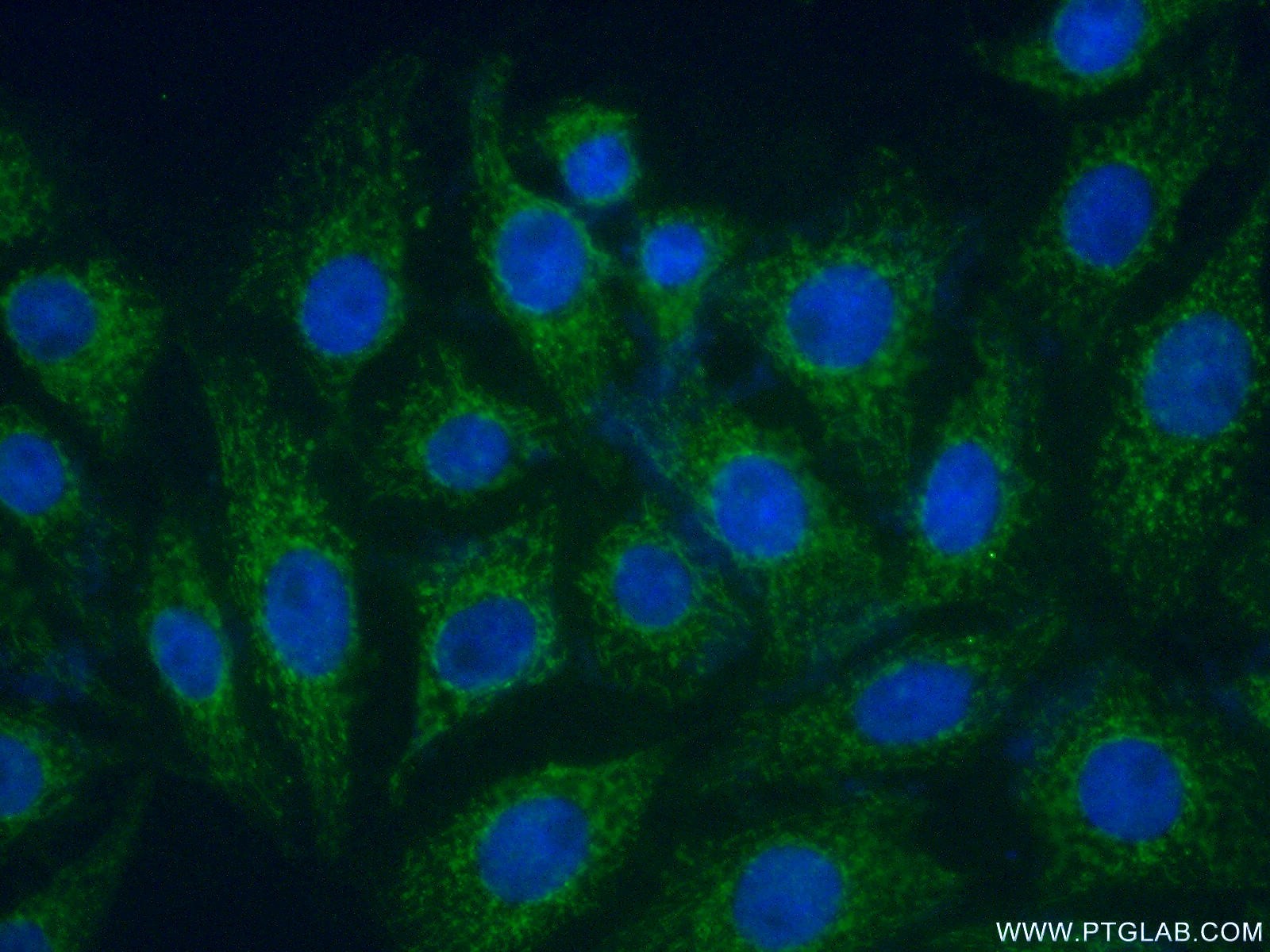 IF Staining of SH-SY5Y using 14060-1-AP