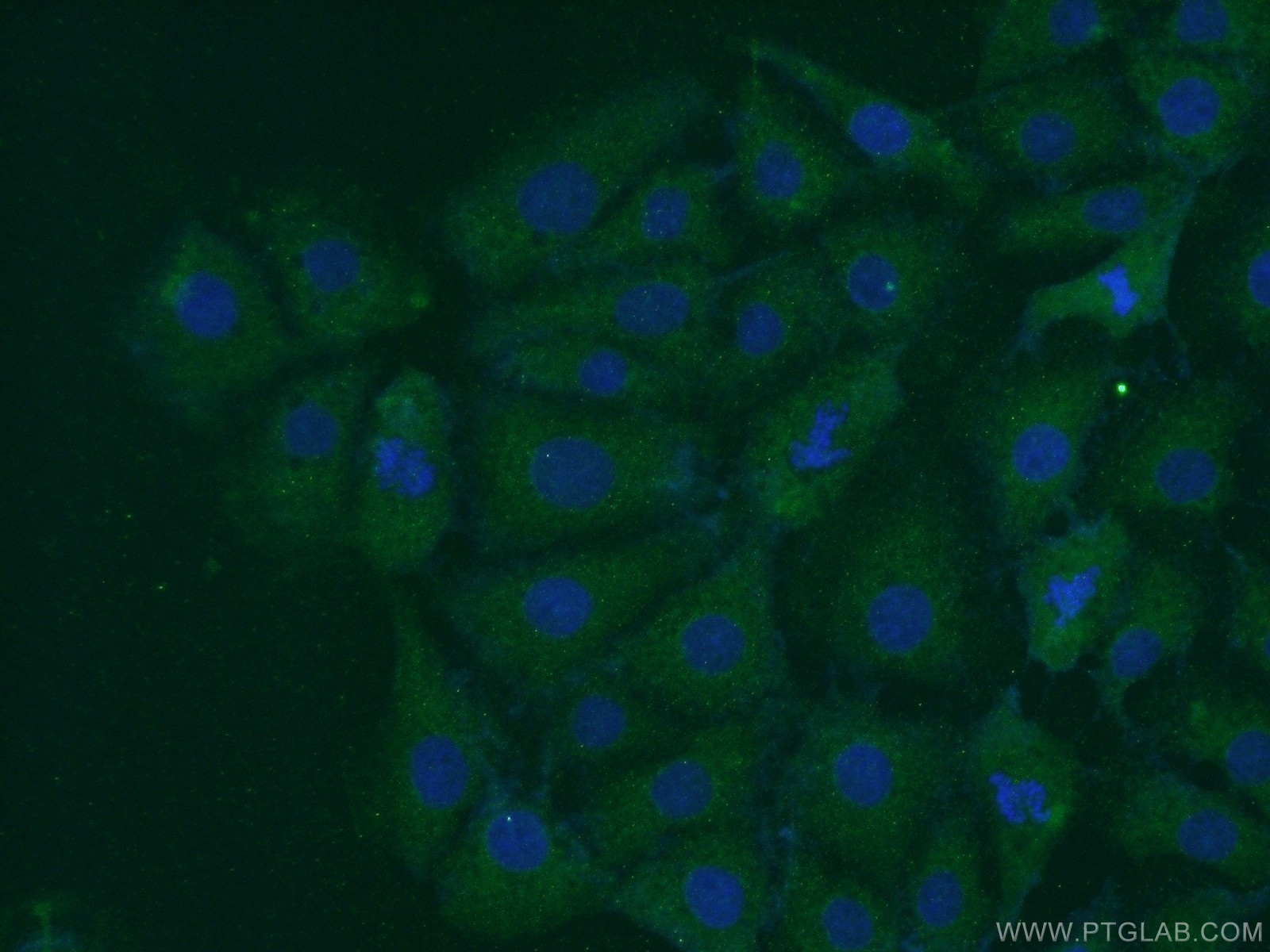 IF Staining of SH-SY5Y using 11681-1-AP