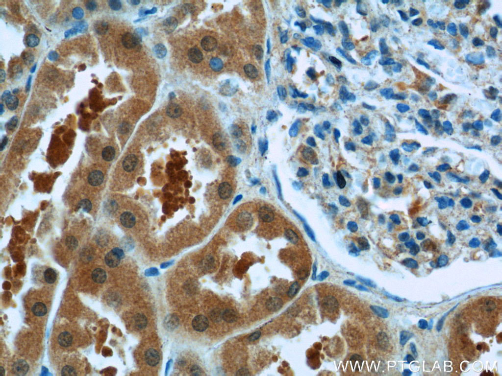 IHC staining of human kidney using 11681-1-AP