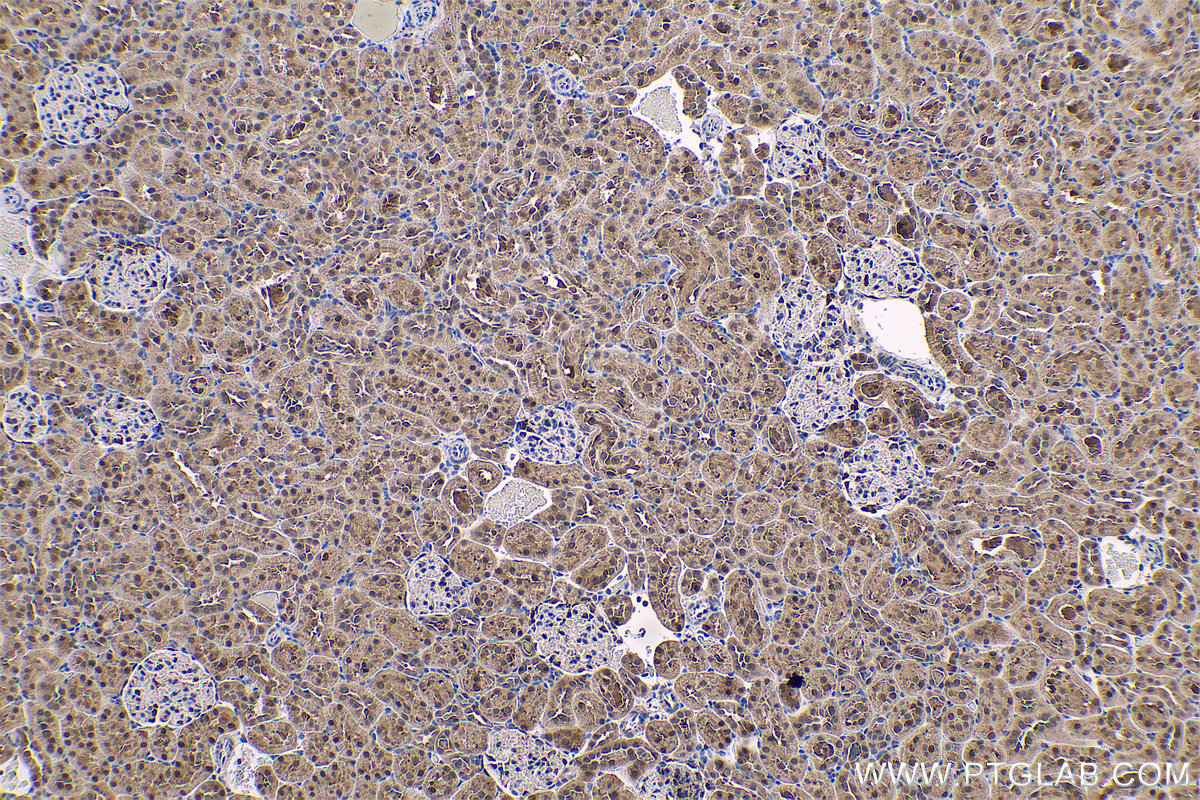 IHC staining of rat kidney using 11681-1-AP