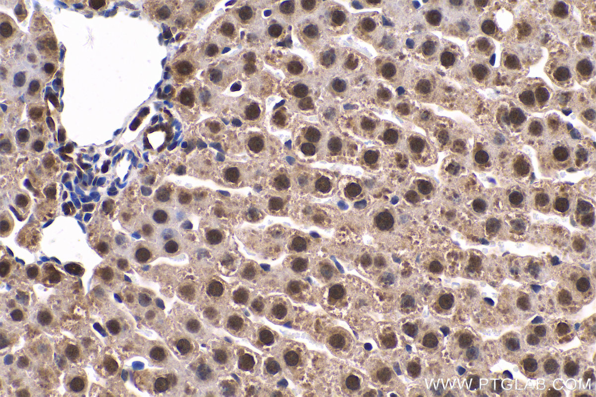 IHC staining of rat liver using 11681-1-AP