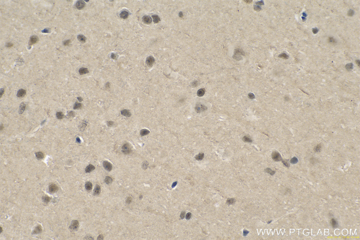 IHC staining of rat brain using 11681-1-AP