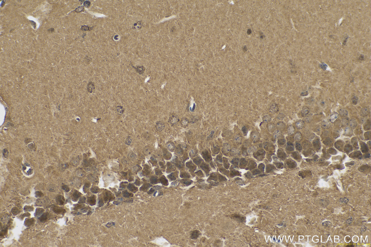 IHC staining of mouse brain using 11681-1-AP