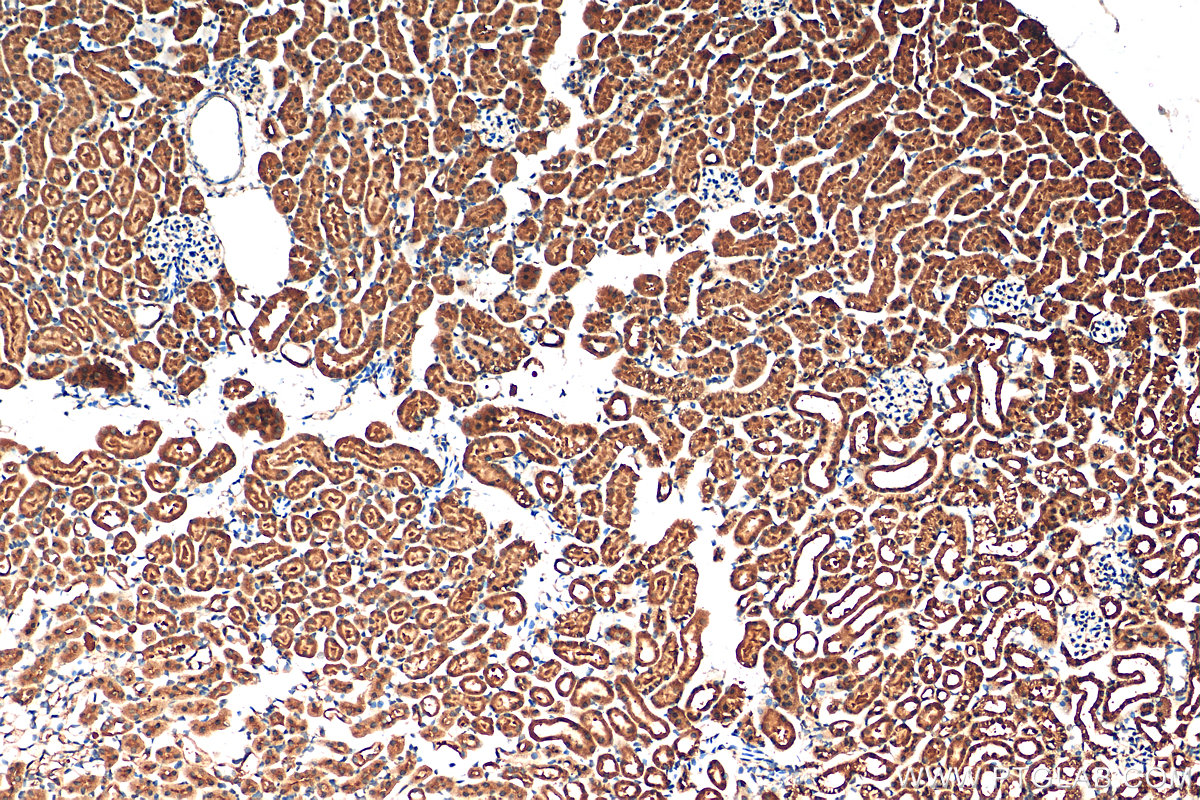 IHC staining of mouse kidney using 11681-1-AP