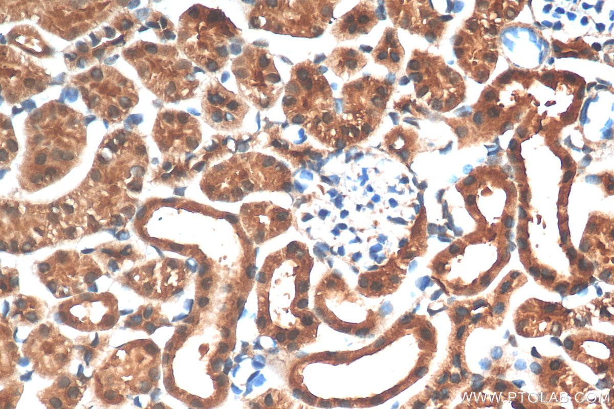 IHC staining of mouse kidney using 11681-1-AP