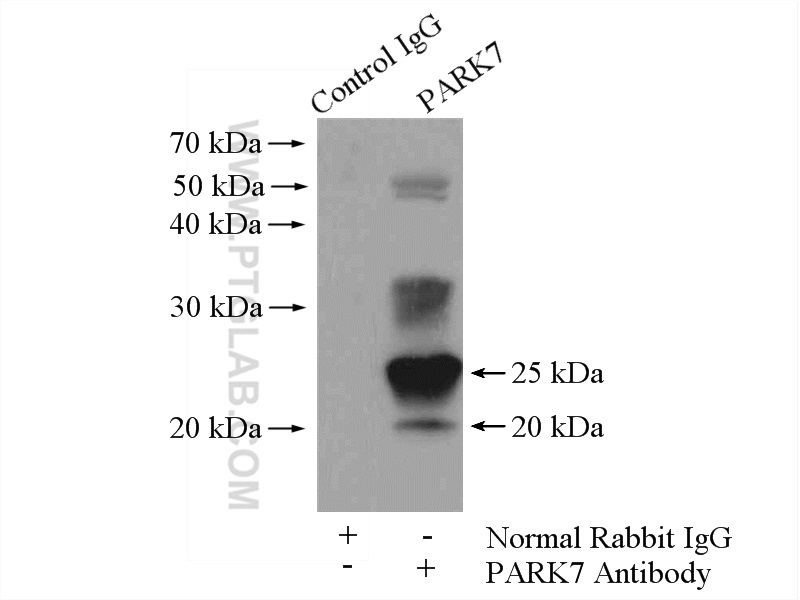 IP experiment of HeLa using 11681-1-AP