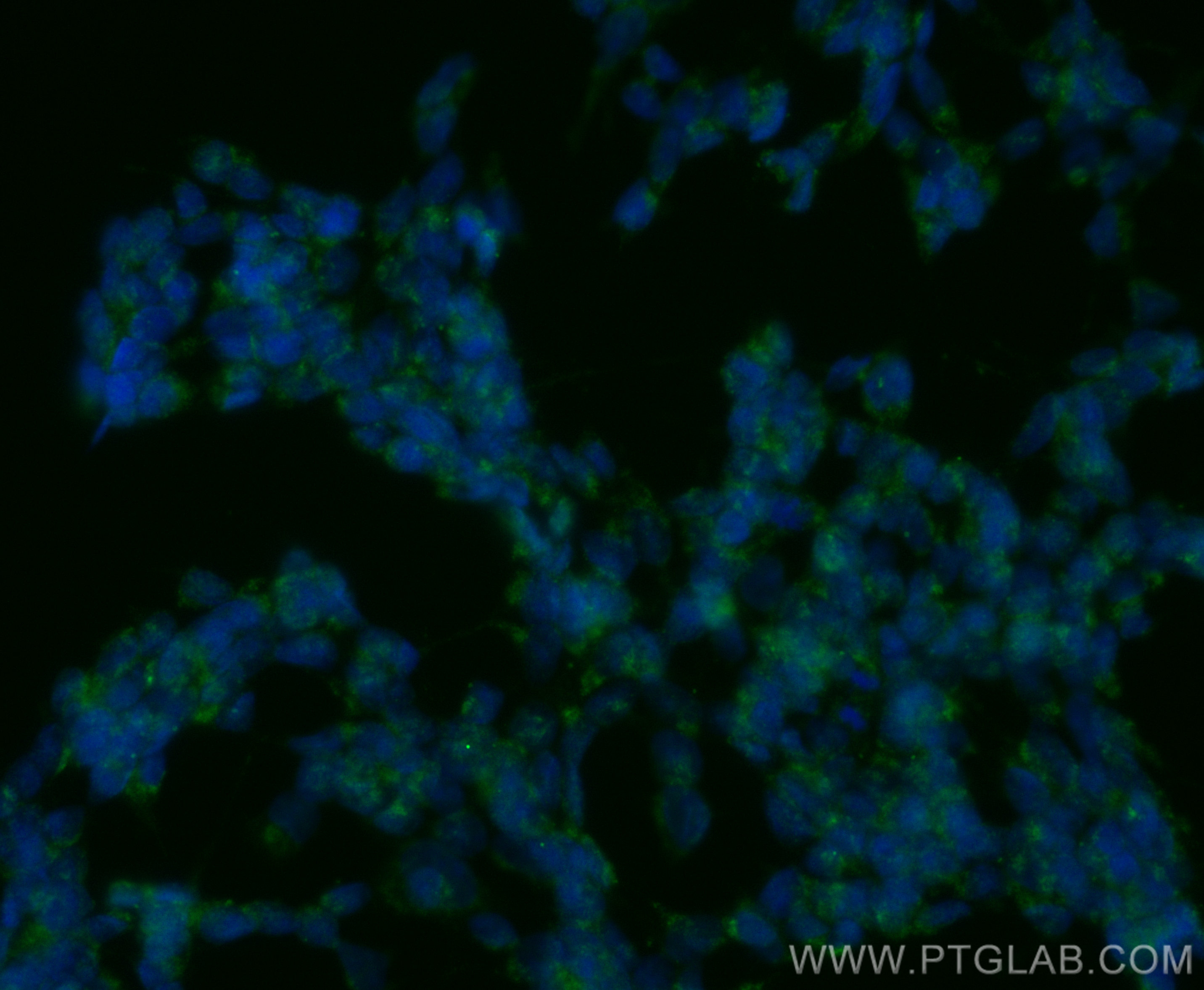 IF Staining of SH-SY5Y using CL488-11681