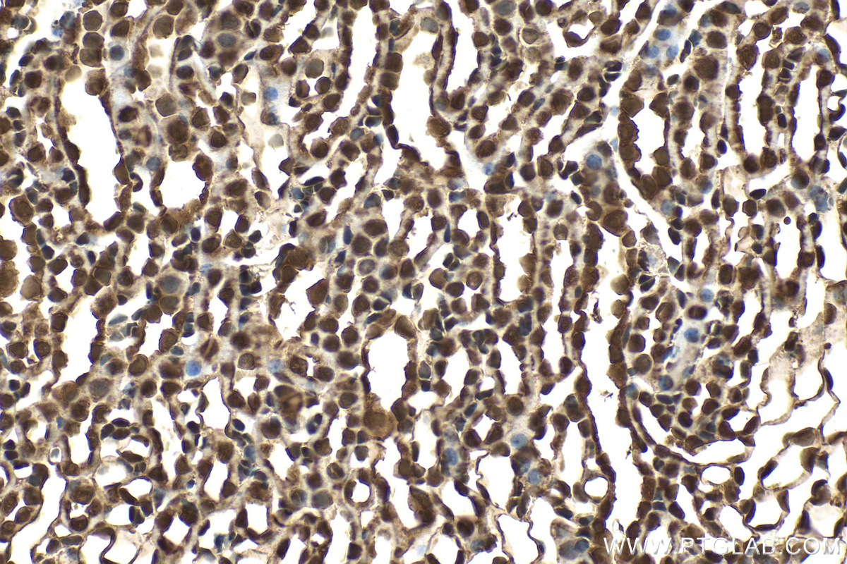 IHC staining of mouse kidney using RMX00059