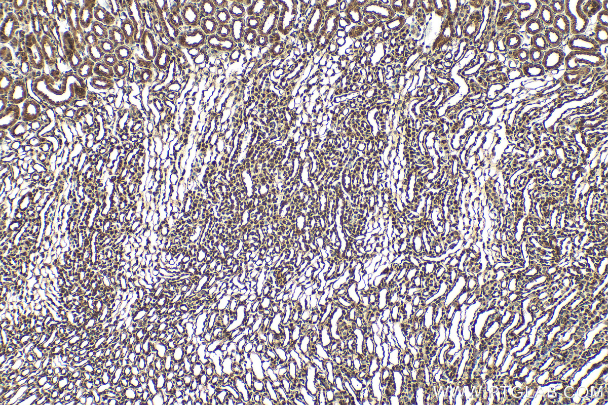 IHC staining of mouse kidney using RMX00059