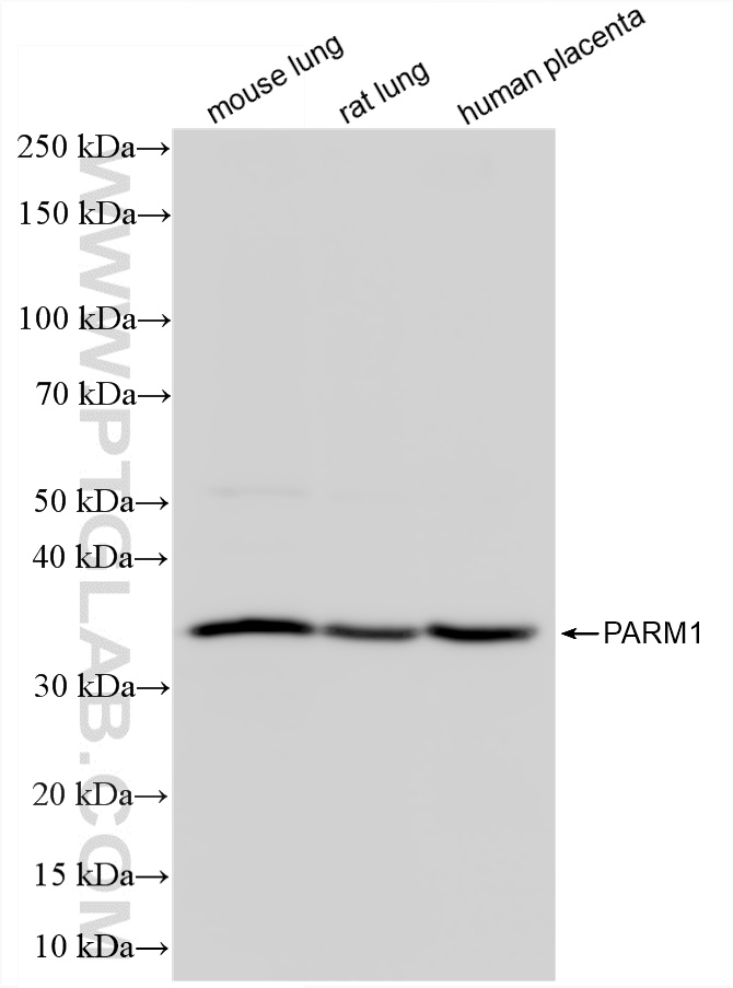 Various lysates were subjected to SDS PAGE followed by western blot with 87241-3-RR (PARM1 antibody) at dilution of 1:3000 incubated at room temperature for 1.5 hours. WB analysis using 87241-3-RR