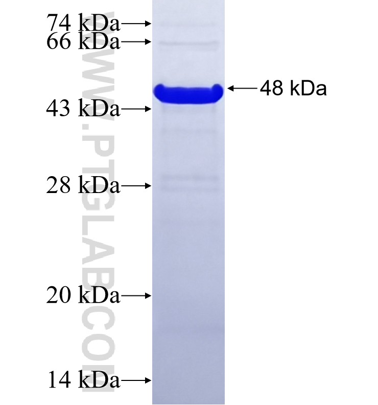 PARM1 fusion protein Ag19992 SDS-PAGE
