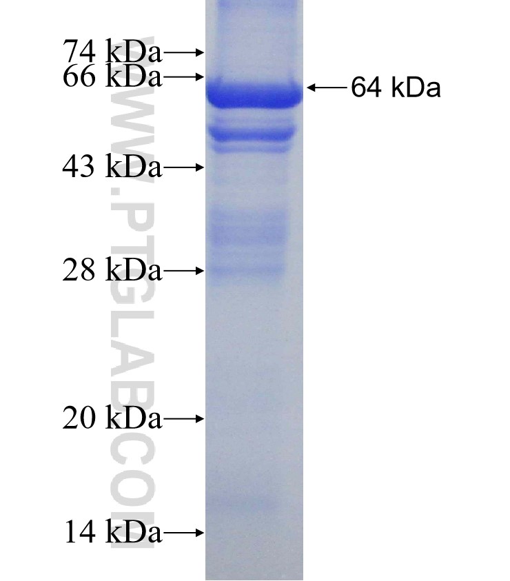 PARN fusion protein Ag4774 SDS-PAGE