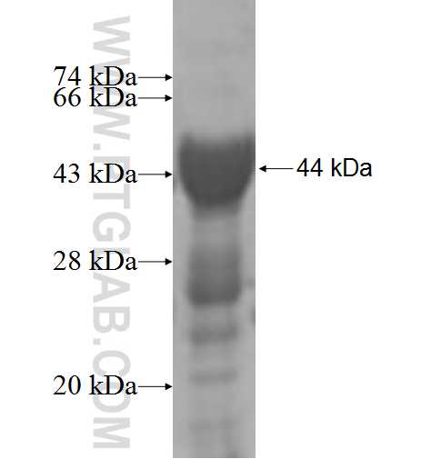 PARN fusion protein Ag4783 SDS-PAGE PARN fusion protein Ag4783 SDS-PAGE