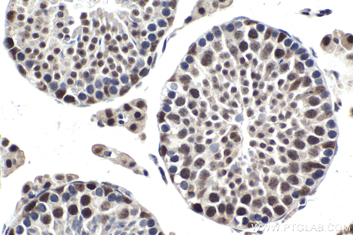 IHC staining of mouse testis using 13371-1-AP