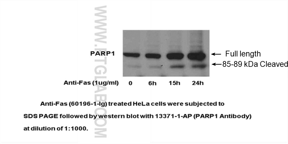 WB analysis of HeLa using 13371-1-AP