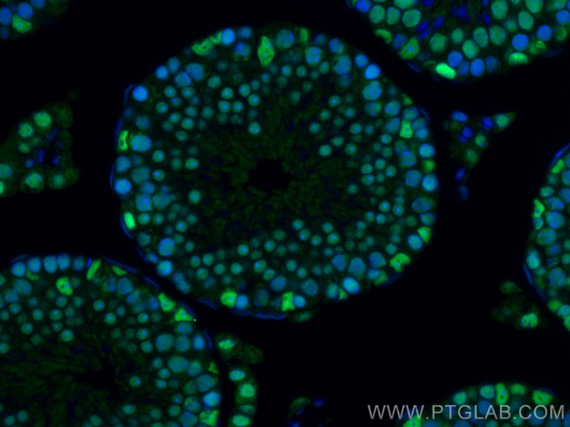 IF Staining of mouse testis using 80174-1-RR (same clone as 80174-1-PBS)