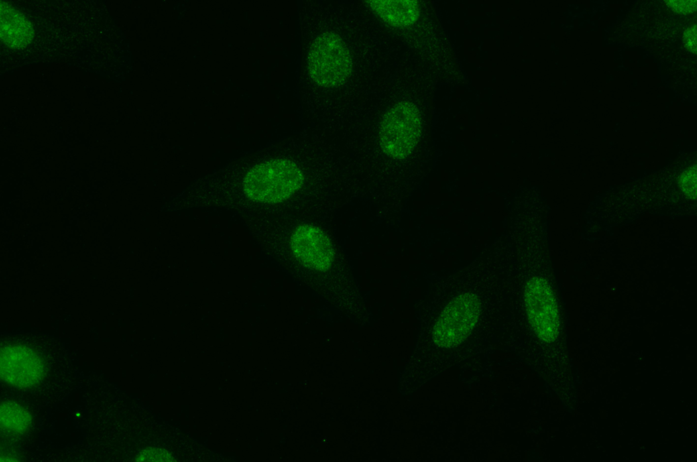 IF Staining of HepG2 using 80174-1-RR (same clone as 80174-1-PBS)