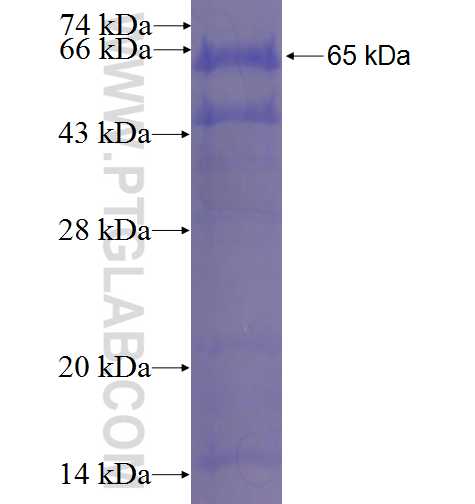PARP10 fusion protein Ag23449 SDS-PAGE PARP10 fusion protein Ag23449 SDS-PAGE