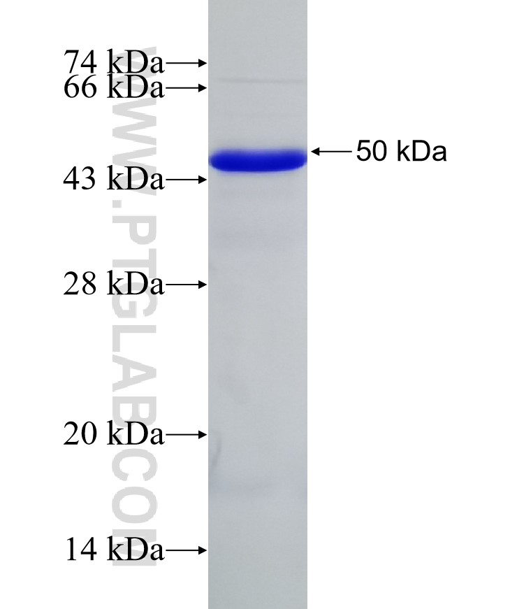 PARP10 fusion protein Ag31978 SDS-PAGE