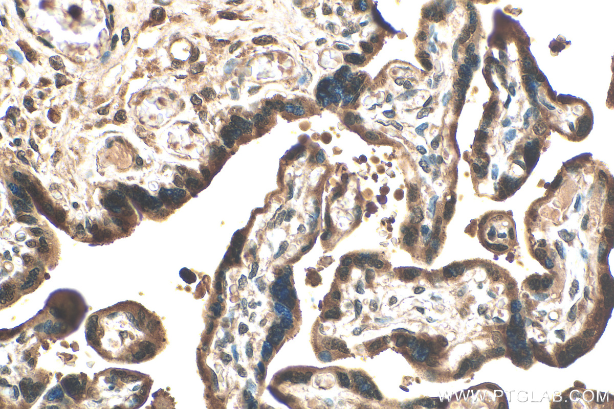 IHC staining of human placenta using 30127-1-AP