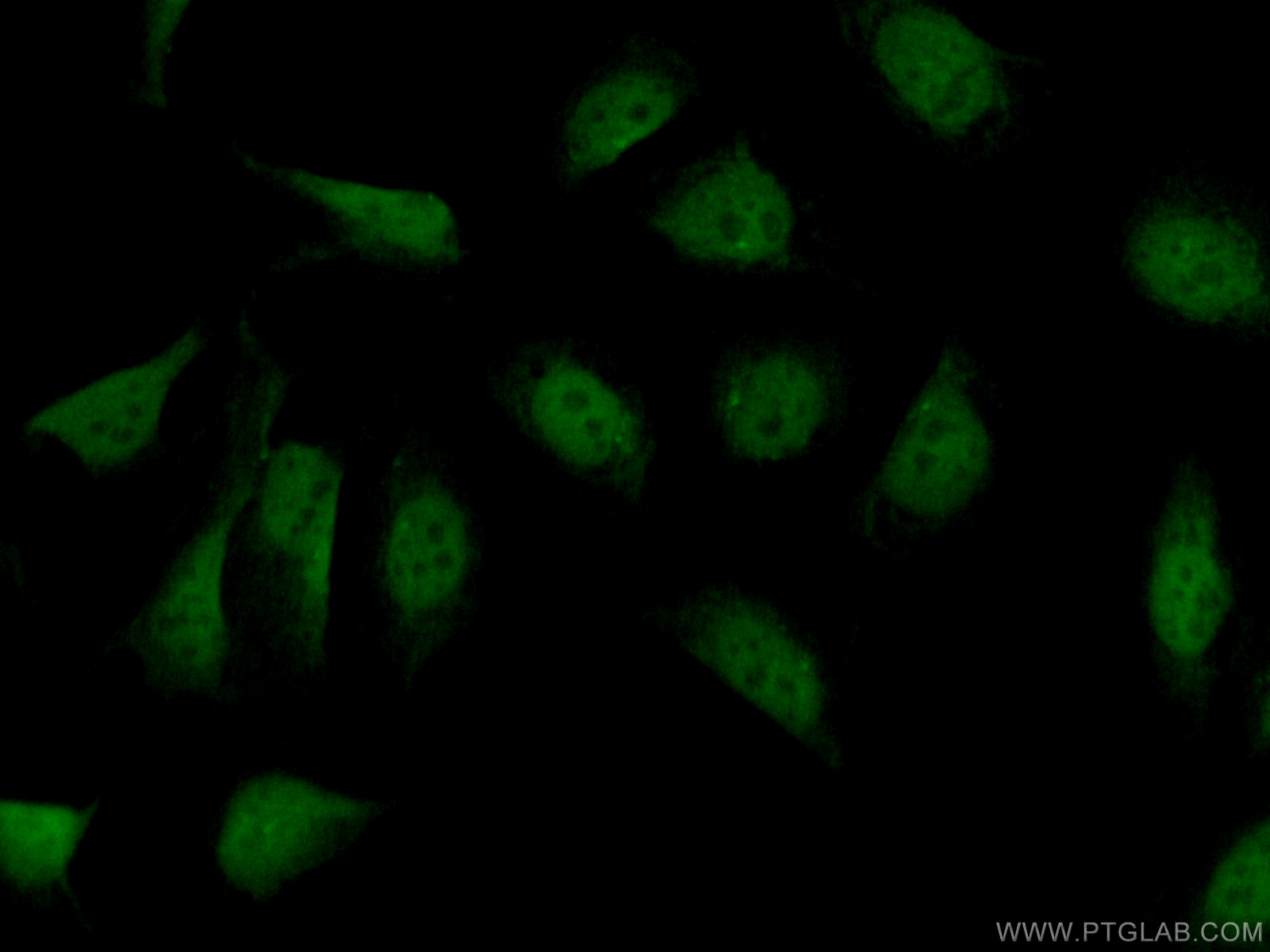 IF Staining of U2OS using 55149-1-AP