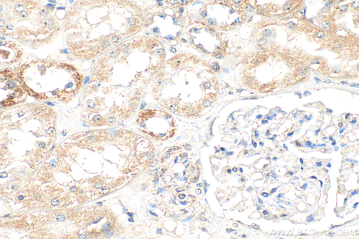 IHC staining of human kidney using 55149-1-AP