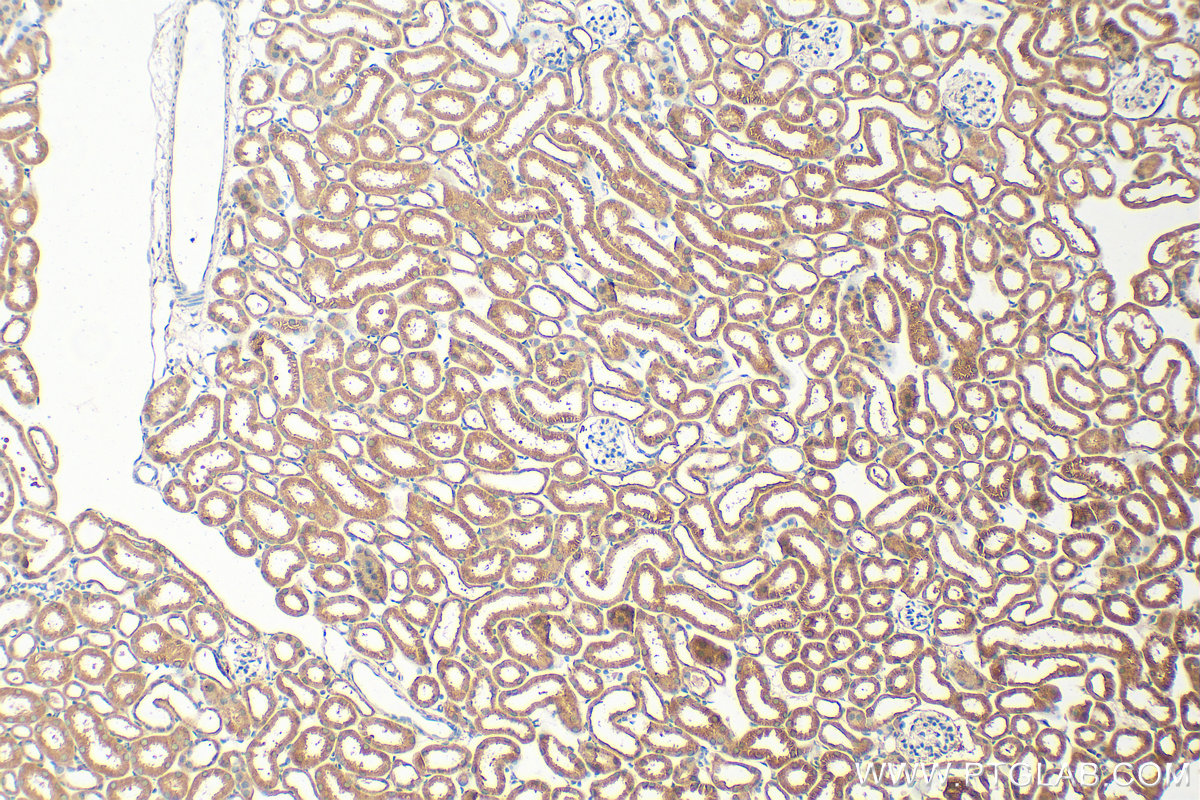 IHC staining of mouse kidney using 19775-1-AP