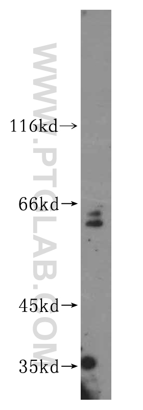 WB analysis of HepG2 using 16945-1-AP