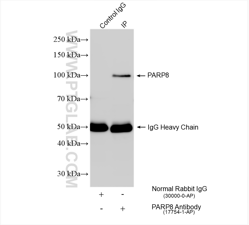 IP experiment of THP-1 using 17754-1-AP