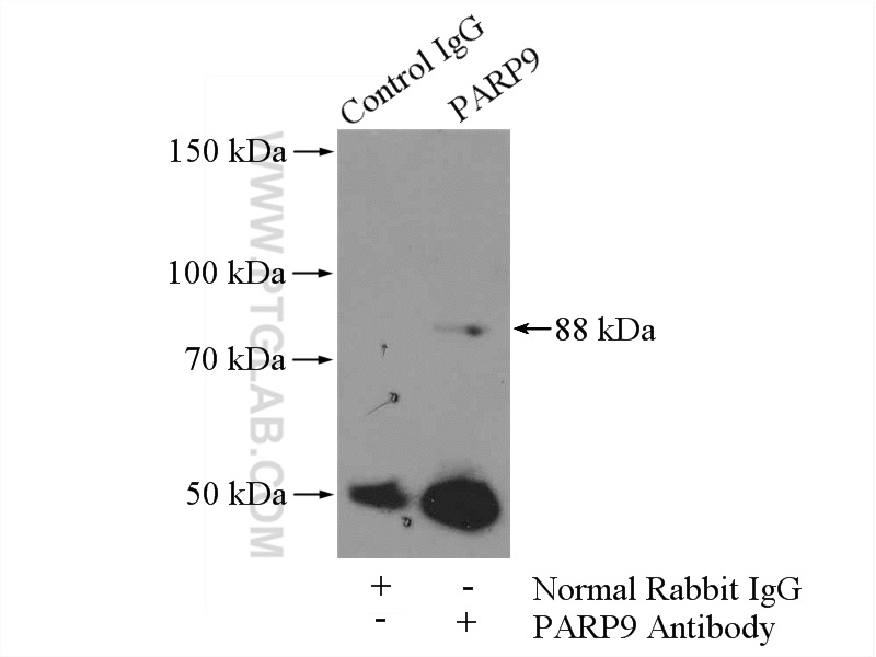 IP experiment of MCF-7 using 17535-1-AP