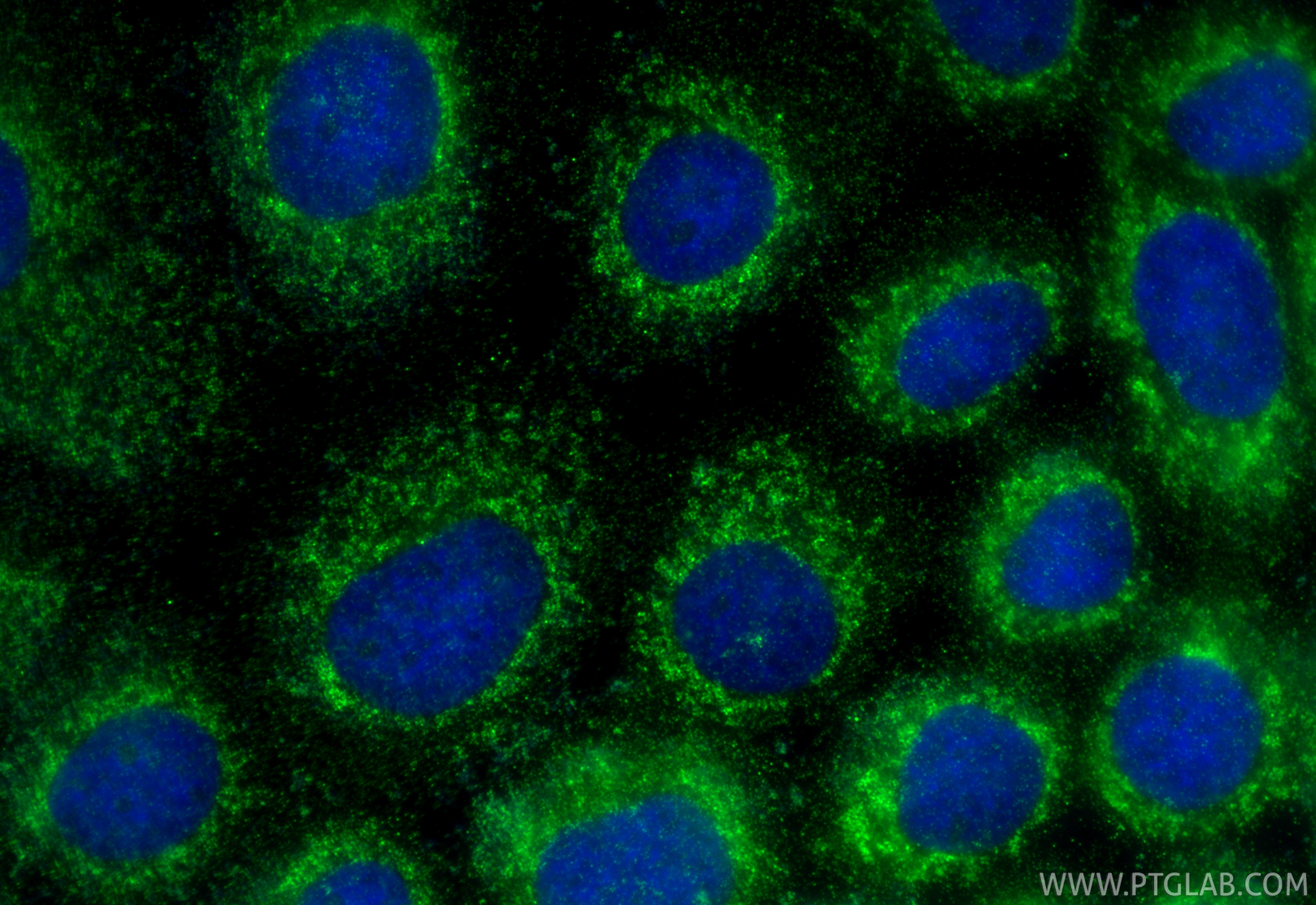 IF Staining of A431 using 15864-1-AP IF Staining of A431 using 15864-1-AP